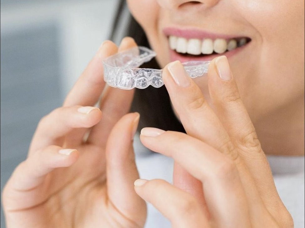 Placing an Invisalign clear aligner
